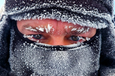 Sơ cứu khẩn cấp cho người bị bỏng lạnh