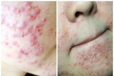 ‘Sát thủ’ ẩn giấu trong những sản phẩm làm đẹp 