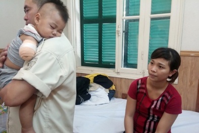 Mẹ bất cẩn, bé 10 tháng tuổi bị xe chở rác cán nát tay phải