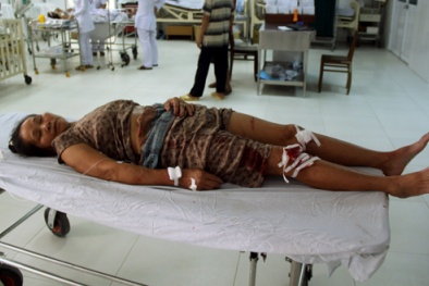 Quảng Nam: Lợn rừng xuống núi cắn nát mặt người dân 