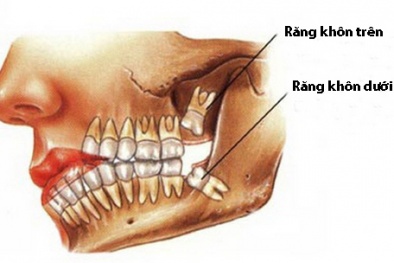 Tìm ra cách giúp người mọc răng không giới hạn