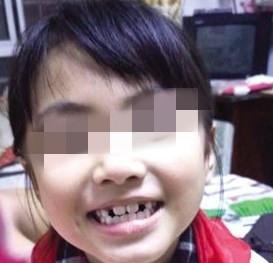 Trung Quốc: Phẫn nộ bé gái 8 tuổi bị bác dâu sát hại do đố kỵ