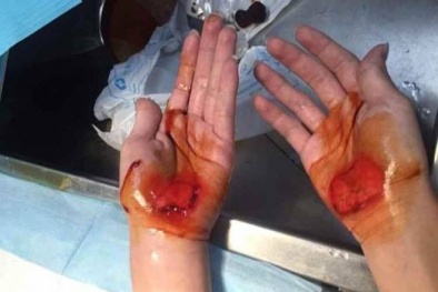 Trung Quốc: Học sinh vào muộn bị phạt đi bộ bằng tay đến chảy máu