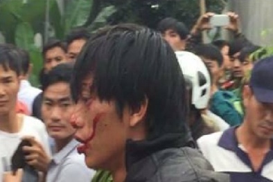 Khởi tố nghịch tử ‘ngáo đá’ chém chết bác và truy sát bố, chú ruột