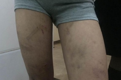 Rơi nước mắt nhìn bé gái 11 tuổi bị bạo hành như thời trung cổ