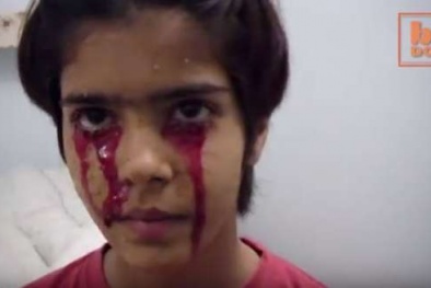 Thiếu nữ Ấn Độ tuyệt vọng vì chứng bệnh khóc ra máu