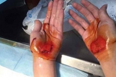 Phẫn nộ các hình phạt dã man của giáo viên tiểu học Trung Quốc 