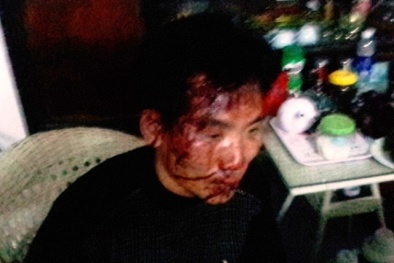 Đã bắt được 6 đối tượng dùng mã tấu chém tới tấp tài xế xe khách