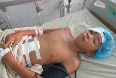 Xe đạp bất ngờ gãy cổ, nam sinh lớp 7 vỡ gan