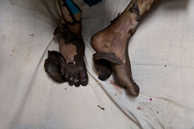 Gã trai máu lạnh tạt xăng thiêu sống người chỉ vì chút mâu thuẫn vặt