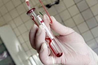 Hà Nội: 18.320 người nhiễm HIV/AIDS