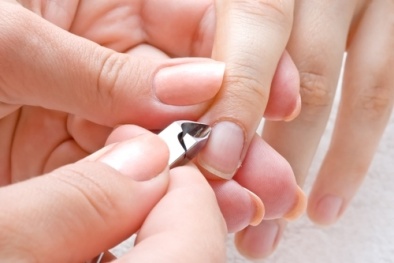 Bí quyết trị xước măng rô hiệu quả