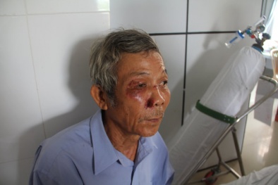 Bị cán bộ phường đánh vì... góp ý với đoàn nghiệm thu?