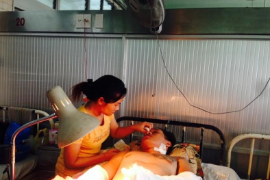 Tp. HCM: Thanh niên đứt lìa bàn tay trái khi đi chơi game bắn cá