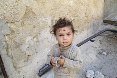 Những tin tức mới cập nhật về tình hình khủng bố IS ngày 9/12/2015