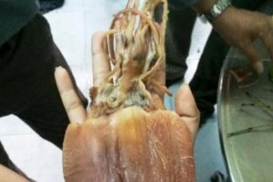 Phát hiện đối tượng bán khô mực giá cực rẻ, nghi làm giả bằng cao su