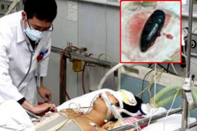 Suýt chết vì ăn canh mật cá trắm