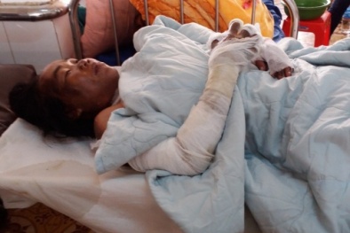 Bé 13 tháng tuổi cùng mẹ 'bốc cháy' trong nhà bếp