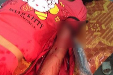 Bắt khẩn cấp đối tượng đâm dao vào tay bé gái đêm Giáng sinh 