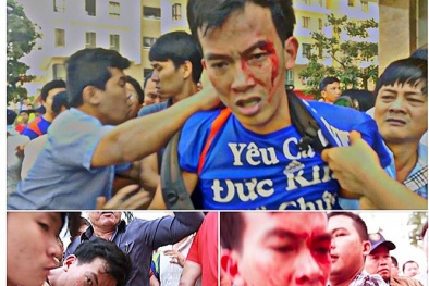 Giám đốc công ty bảo vệ ở Era Town nói người dân 'tự té ngã, đổ máu'