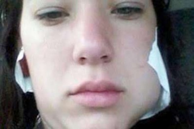 Thiếu nữ bị người yêu cắt lưỡi vì đòi chia tay