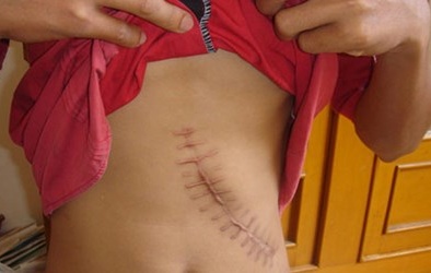 Tài xế taxi cầm đầu đường dây mua bán thận