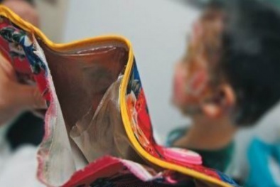  Nguy cơ ngạt khí, bỏng điện vì sưởi ấm