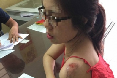 Lại xuất hiện cướp kéo lê nạn nhân đi giữa trung tâm Sài Gòn