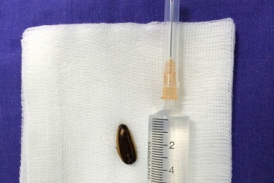 Suýt chết vì hạt hướng dương ngày Tết