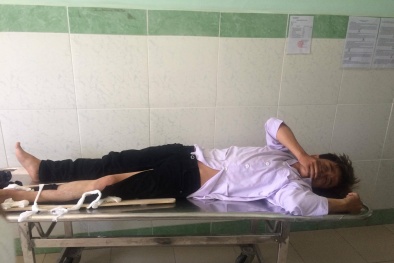 Vụ CSGT bị tông gãy chân: Chiến sĩ CSGT cũng có lỗi