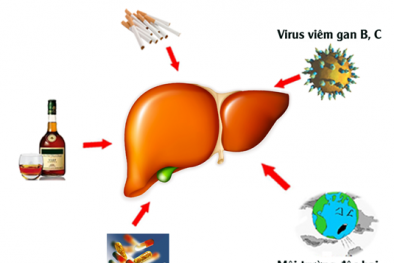 4 nguyên nhân 'thầm lặng' gây bệnh xơ gan nguy hiểm