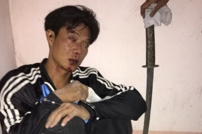 Bắn 5 phát súng chỉ thiên, tên cướp 'lì lợm' vẫn dùng mã tấu chống trả