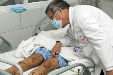 Hà Nội: Lo ngại viêm màng não mô cầu 'tấn công' mạnh với ca thứ 2