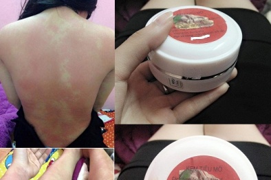 Kem tan mỡ: 'đốt tiền đốt cả sức khỏe'