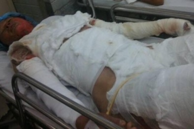 Tin pháp luật an ninh 24h qua: Chồng tưới dầu thiêu sống vợ trong men say