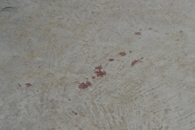 Em chồng chém chị dâu chỉ vì 50.000 đồng