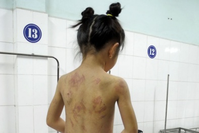 Trót tiêu nhiều hơn con chung 1.000 đồng, con riêng bị mẹ ghẻ quật tơi tả