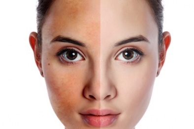 Bật mí bí quyết sở hữu làn da tươi sáng đều màu 