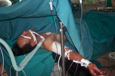 Phẫu thuật ghép nối tay thần kì cho người đàn ông bị chém đứt lìa