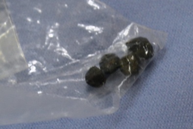 Tin pháp luật an ninh 24h qua: Chú 3 tuổi bắn đạn chì vào chân cháu 9 tháng tuổi