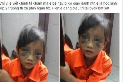 Cô giáo đánh nữ sinh tiểu học tím mặt có thể sẽ bị xử lý hình sự