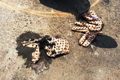 Hai nữ sinh viên bị tạt axit giữa phố Sài Gòn: Đầu tóc và mặt bốc khói