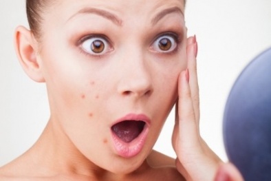 5 thực phẩm càng ăn da càng xấu