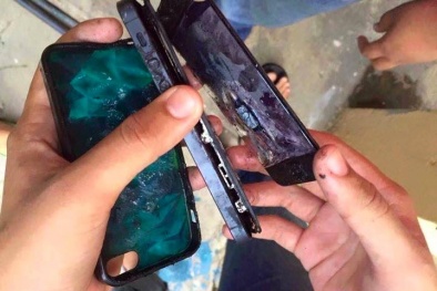 LG lao đao vì điện thoại phát nổ gây bỏng cho người dùng