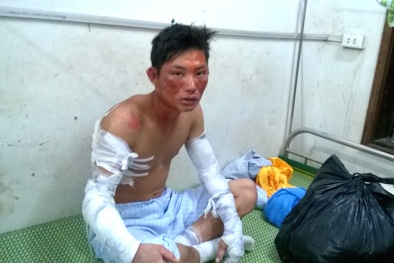 Nổ kinh hoàng ở nhà máy sắn Nghệ An: Các nạn nhân đều không có bảo hiểm?