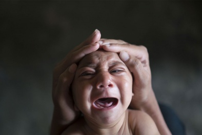 Virus Zika ăn não người: Nguy cơ lan tới Hà Nội là rất lớn
