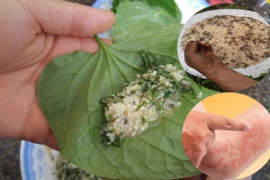 Sưng mặt vì ăn... trứng kiến 