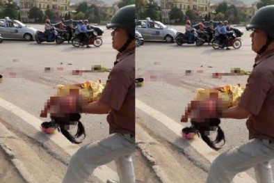 Lạnh người ô tô cán đứt lìa chân mẹ, con bé gái 6 tuổi nguy kịch