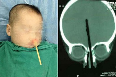 Con bạn có thể nguy hiểm đến tính mạng nếu bạn coi thường điều này