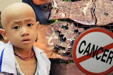 Loạn cảnh báo ung thư, người Việt đang tự hù dọa mình!